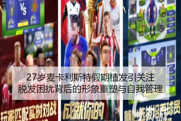 27岁麦卡利斯特假期植发引关注 脱发困扰背后的形象重塑与自我管理